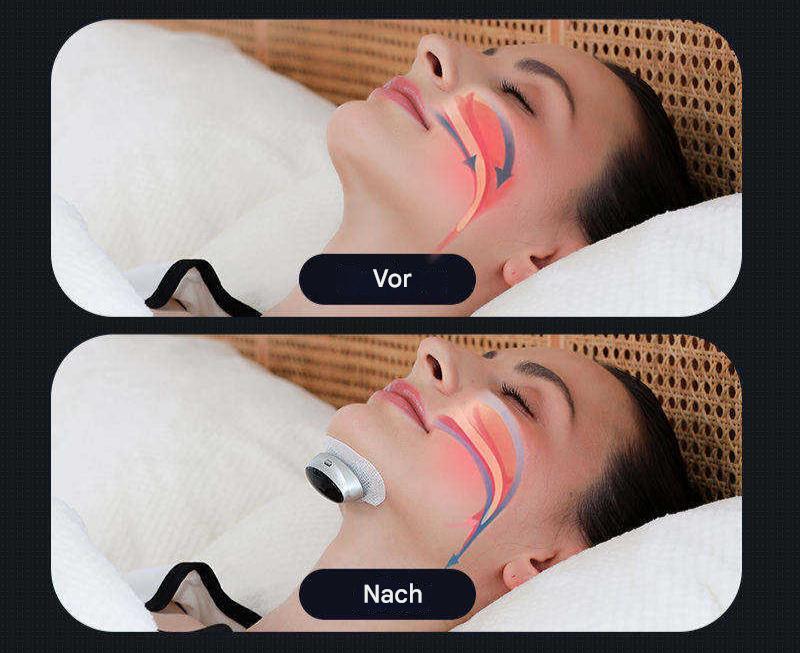 Appareil pour l’apnée du sommeil