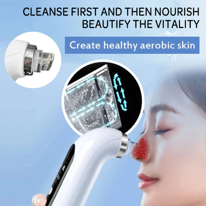 Aspirateur de points noirs professionnel pour le nez - nettoyage en profondeur avec technologie d’aspiration
