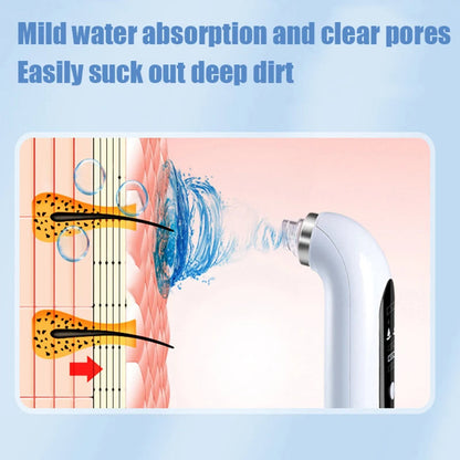 Aspirateur de points noirs professionnel pour le nez - nettoyage en profondeur avec technologie d’aspiration