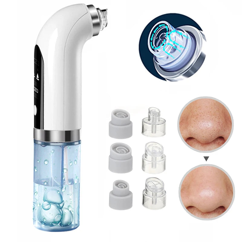 Aspirateur de points noirs professionnel pour le nez - nettoyage en profondeur avec technologie d’aspiration