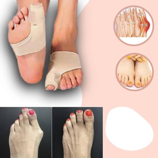 Correcteur d’hallux valgus pour soulager la douleur