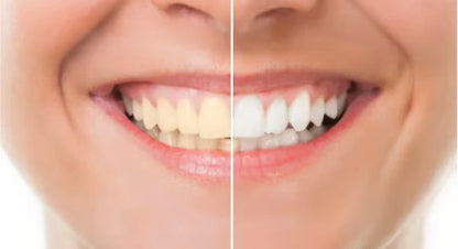 Dents plus blanches et haleine fraîche