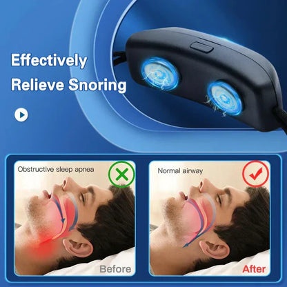 Dispositif anti-ronflement à impulsions EMS - aide au sommeil portable