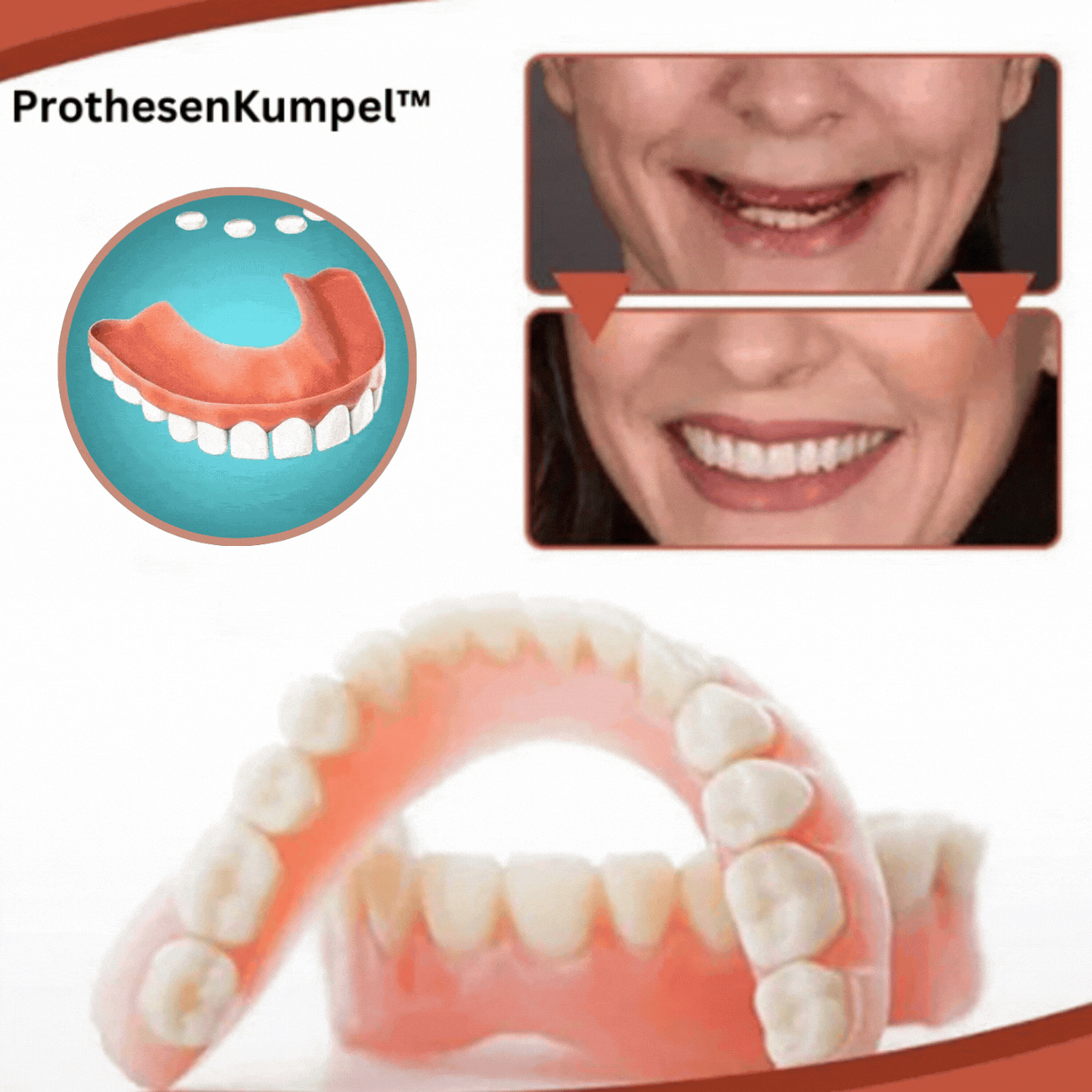 Ensemble de prothèses dentaires en silicone biocompatible pour un ajustement indolore et un sourire naturel