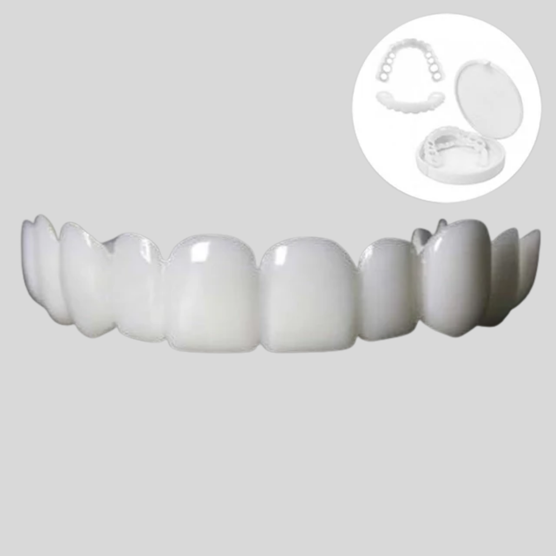 Facettes dentaires à clipser, embellissement du sourire