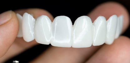 Facettes dentaires esthétiques à clipser | Couverture instantanée du sourire pour les imperfections