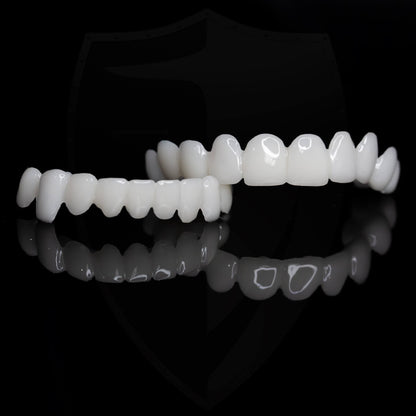 Facettes dentaires esthétiques à clipser | Couverture instantanée du sourire pour les imperfections