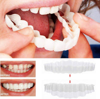 Facettes dentaires (haut et bas inclus)