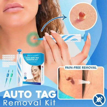 Kit applicateur automatique d’élastiques pour acrochordons