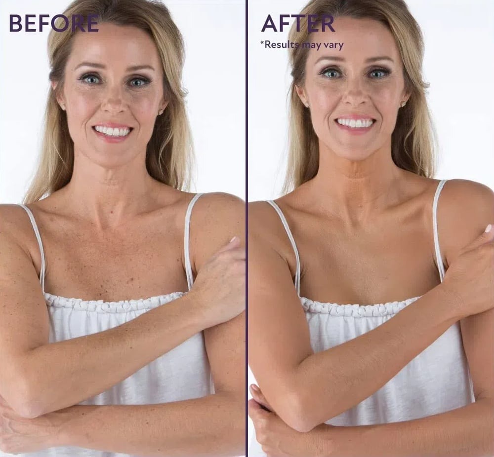 Perfecteur de peau pour le corps zéro défaut