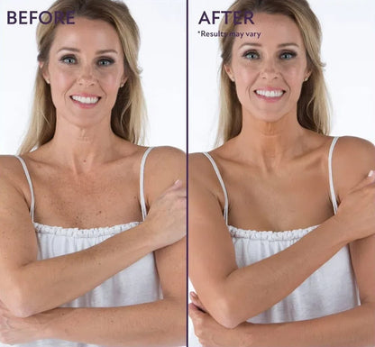 Perfecteur de peau pour le corps zéro défaut
