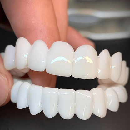 Prothèse dentaire avec facettes blanches