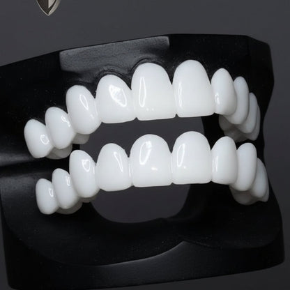 Prothèse dentaire avec facettes blanches