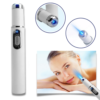 Stylo laser bleu pour un teint plus uniforme