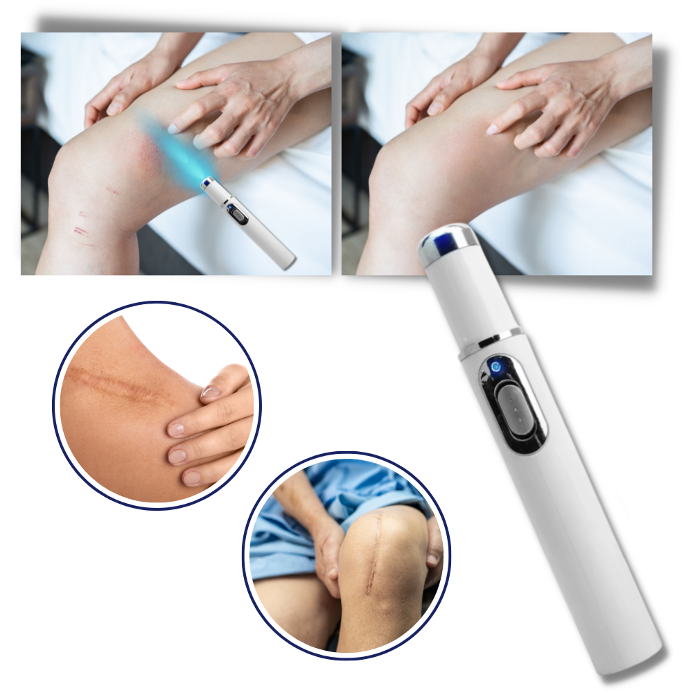 Stylo laser bleu pour un teint plus uniforme