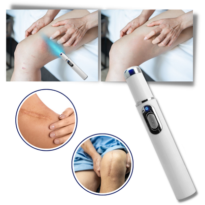 Stylo laser bleu pour un teint plus uniforme