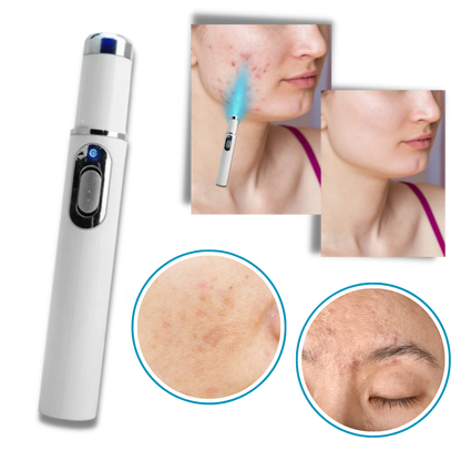 Stylo laser bleu pour un teint plus uniforme