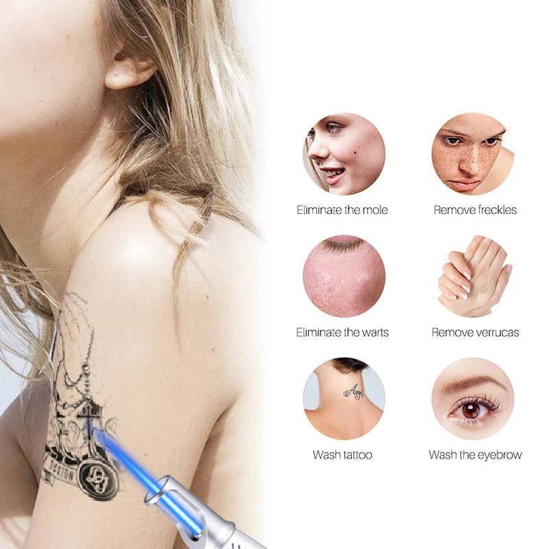 Stylo laser picoseconde effaceur d’imperfections de la peau